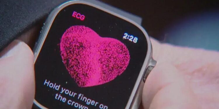 Estudo da Apple Revela Novo Modelo para Análise da Saúde dos Usuários 1 Estudo da Apple Revela Novo Modelo para Análise da Saúde dos Usuários